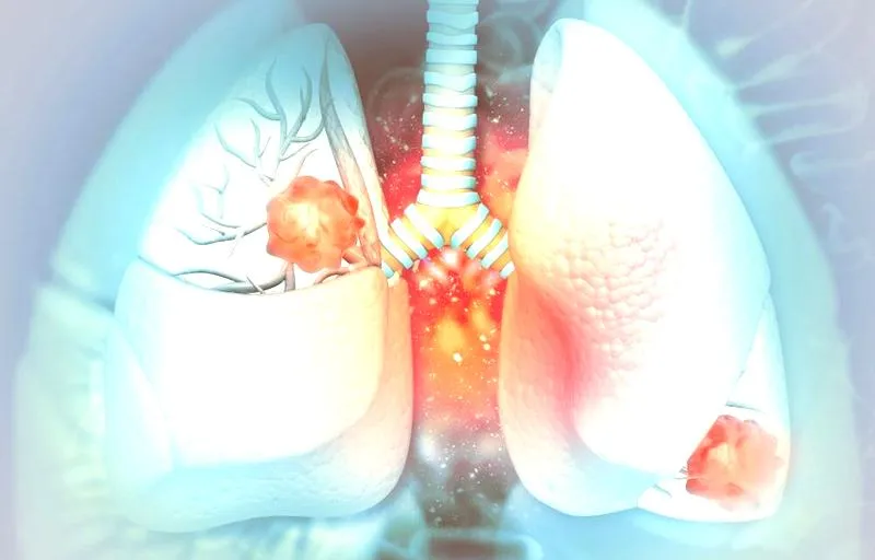 Immunoterapia i chemioterapia